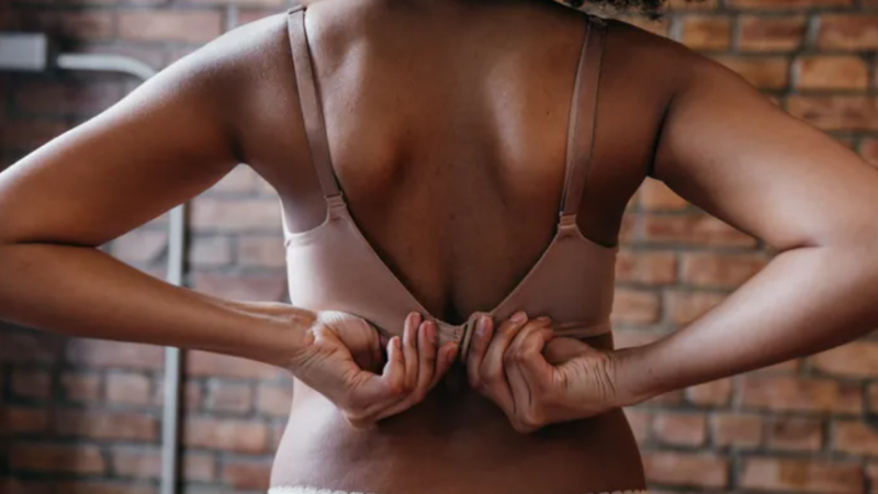 The Trend of Bra Line Back Lifts on TikTok: Insights from Medical Professionals